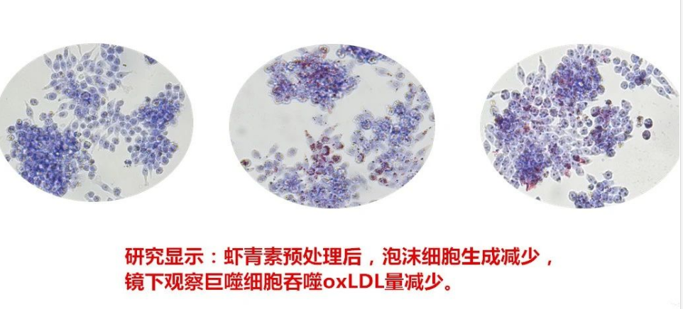 艾詩特蝦青素